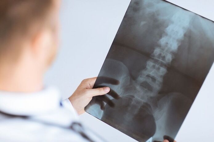 Diagnostic options for lumbar osteochondrosis