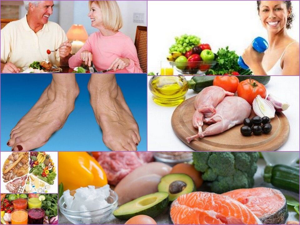 Principles of nutrition for those suffering from knee arthrosis